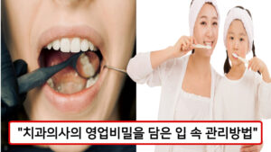 치과의사의 영업비밀 양치 방법