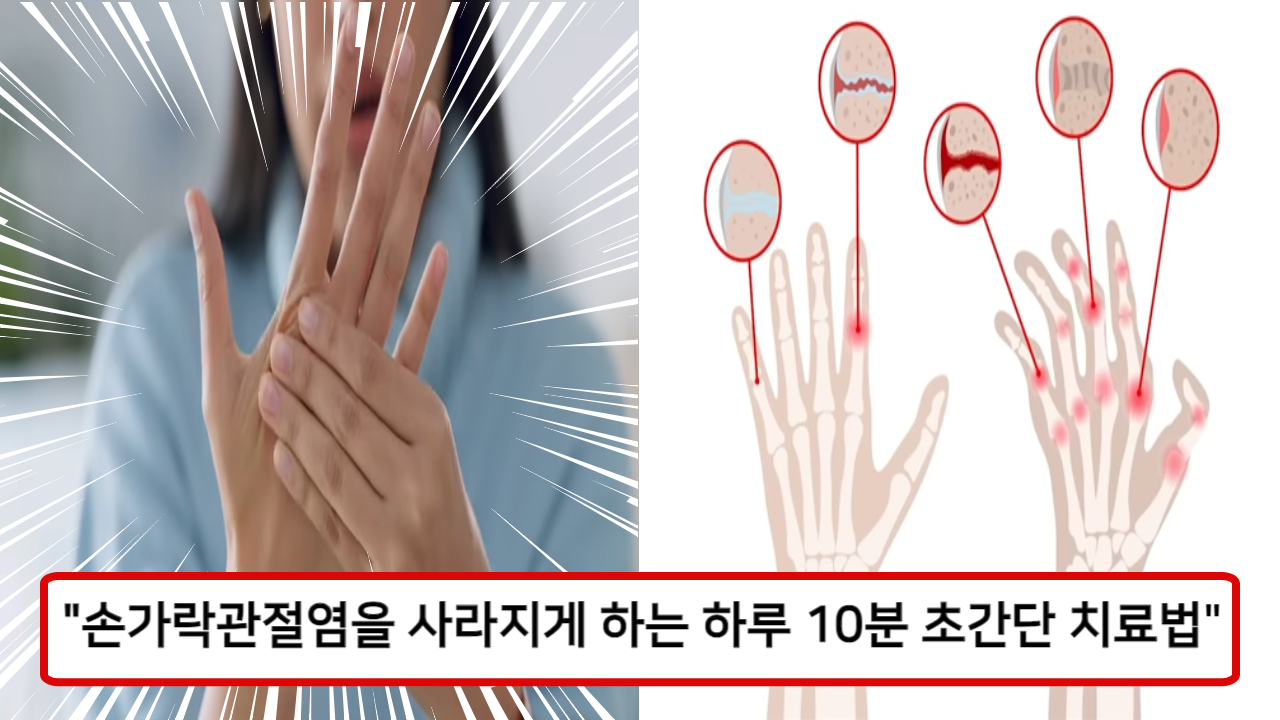 손가락관절염을 사라지게 하는 운동법